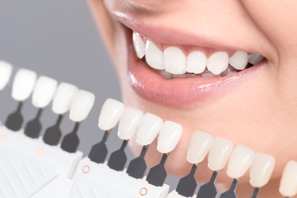 teeth whitening in winnipeg